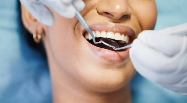 Best Emergency Treatment for Dental Infections or Abscesses in North Fond Du Lac, WI